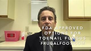 FDA Approved Options For Toenail Fungus [upl. by Salvidor800]