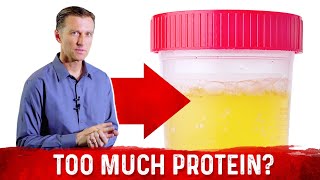 Top 5 Symptoms Of Eating Too Much Protein – DrBerg [upl. by Sedberry349]