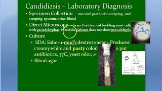 Microbiology 585 c Candida SDA agar germ tube test reynolds braude phenomenon CHROM agar [upl. by Minna292]