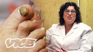 Meet a Toenail Fungus Expert [upl. by Aihsena]