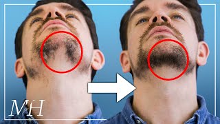 How To Fix Your Patchy Beard… Fast [upl. by Nnaeitak732]