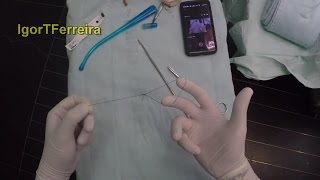 How to Make Laparoscopic Endoloop in 37 seconds [upl. by Dominy]