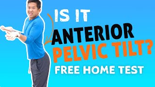 Do I Have Anterior Pelvic Tilt Common APT Myths Busted [upl. by Belamy]