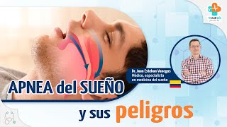 Trastorno del sueño Apnea del sueño síntomas diagnostico y tratamiento [upl. by Floridia897]