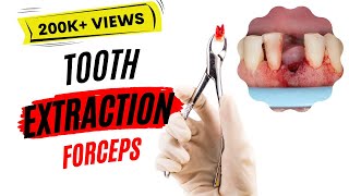 Dental extraction  Forceps [upl. by Lleumas797]