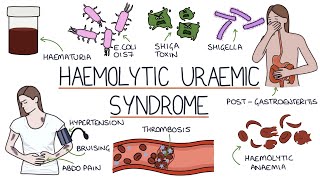 Haemolytic Uraemic Syndrome [upl. by Abbi]