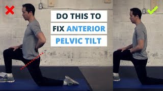 6 Minute Routine to Correct ANTERIOR Pelvic Tilt [upl. by Hobie]