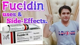 fucidin cream uses and side effects [upl. by Nyladnek]