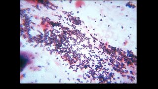 Micro Lab 4 Bacterial Structure Simple Stains Negative Stains Gram amp AcidFast Stains [upl. by Evonne]