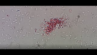 Escherichia coli [upl. by Snehpets]