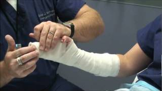 Splint Workshop 3  Ulnar Gutter Splint [upl. by Gerome]