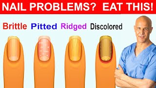 NAIL PROBLEMS  EAT THIS  Dr Mandell [upl. by Antonella]