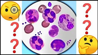 Neutrophils Absolute Count – High Low Causes Normal Range [upl. by Sharleen]