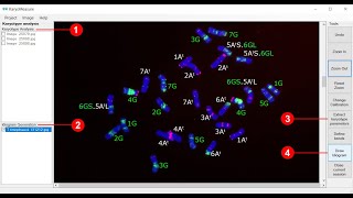 Karyotype analysis using KaryoMeasure [upl. by Hametaf]