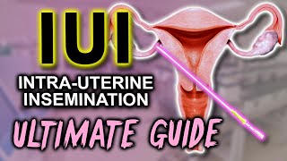 IUI  Fertility expert secrets for maximum pregnancy rates [upl. by Anaib]