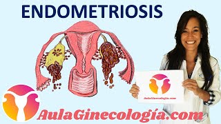 Chronic ENDOMETRITIS on Hysteroscopy [upl. by Tomi270]