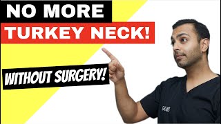 The NONSURGICAL turkey neck lift [upl. by Fonseca323]