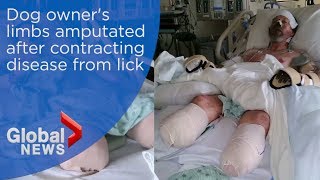 Dog owners limbs amputated after contracting rare infection from lick [upl. by Cirdahc]