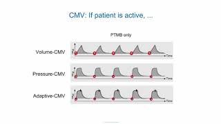 eLearning Ventilation modes ABC [upl. by Dine]