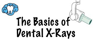 How to Read Dental XRays [upl. by Lasorella216]