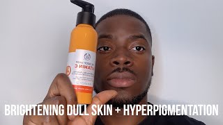 HOW I GOT RID OF DARK SPOTS BRIGHTEN DULL SKIN  HYPERPIGMENTATION [upl. by Dianemarie]