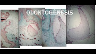 Embriología dentaria Odontogénesis [upl. by Aiykan]