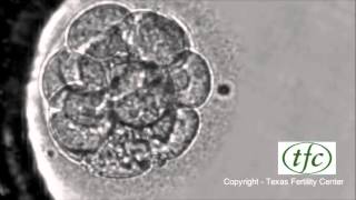 Human Embryo Growing from Fertilization to Day 6 Blastocyst [upl. by Alemrac]