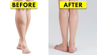 How I Slimmed Down My HUGE Calves  Scientific Approach [upl. by Nosraep255]