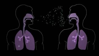 How Tuberculosis Begins [upl. by Atteyram]