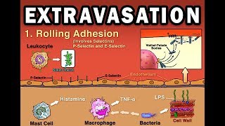 EXTRAVASATION [upl. by Tiana]