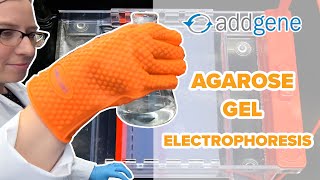 Agarose Gel Electrophoresis [upl. by Ogdon282]