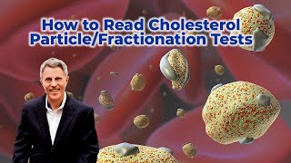 How to Read Cholesterol ParticleFractionation Tests [upl. by Ishii]