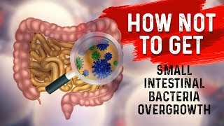 How to STOP Small Intestine Bacterial OvergrowthSIBO – Dr Berg [upl. by Gnuy546]