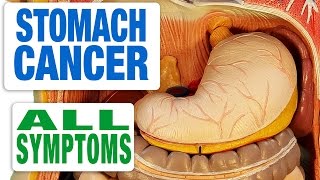 Stomach Cancer  All Symptoms [upl. by Adieno]