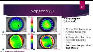 How to read MS39 AS OCT Corneal Topography DrYasser RIFAY  ENGLISH  Phoenix 37 [upl. by Almund330]