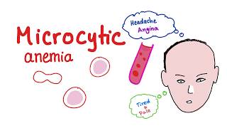 Microcytic Anemia introduction [upl. by Cawley]