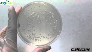 SDSabouraud Dextrose Agar [upl. by Lebisor740]