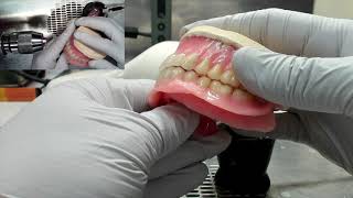 Denture Tooth Repairs [upl. by Ina]