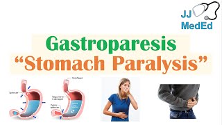 Gastroparesis Stomach Paralysis  Causes and Risk Factors Signs amp Symptoms Diagnosis Treatment [upl. by Boys]