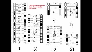 Cytogenetics II Chromosome Analysis amp Karyotypes [upl. by Junji]