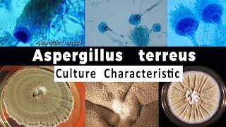 Aspergillus Terreus Culture Characteristic [upl. by Jillie480]