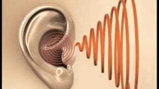 Extremely Powerful Tinnitus Sound Therapy  Remedy for Tinnitus Ears Sound [upl. by Arracahs]