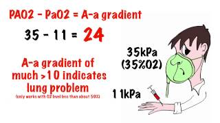 Arterial blood gas interpretation in 5 min [upl. by Roselani]