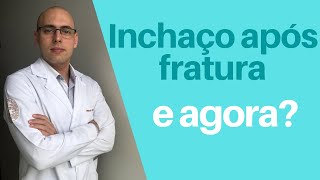 INCHAÇO APÓS FRATURA CIRURGIA OU GESSO  O que fazer É normal [upl. by Benilda]