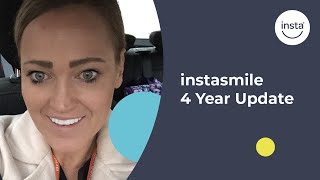 Clip On Veneers 4 Year Update  Instasmile Review [upl. by Lindsy]