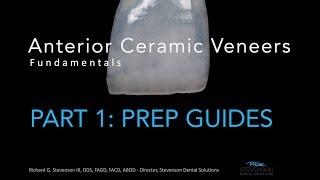 Anterior Ceramic Veneers Part 1 Preparation Guides [upl. by Nanon]