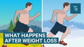 What Losing Weight Does To Your Body And Brain  The Human Body [upl. by Ainahs]