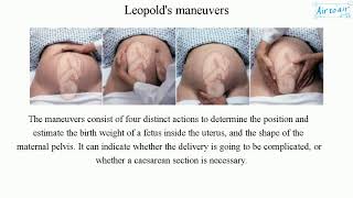 Leopolds maneuvers [upl. by Elurd897]