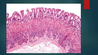 HISTOLOGIA DEL ESTOMAGO [upl. by Deloria825]