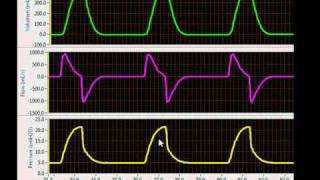 Ventilator Mode Classification Breathing Patterns [upl. by Upton]